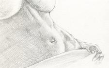 Laparoscopy