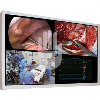 "Medical Monitor, 55"", 4K UHD" 