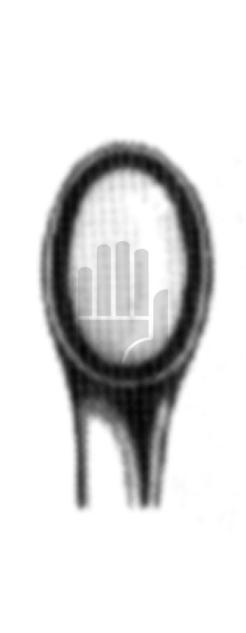 Daubenspeck 