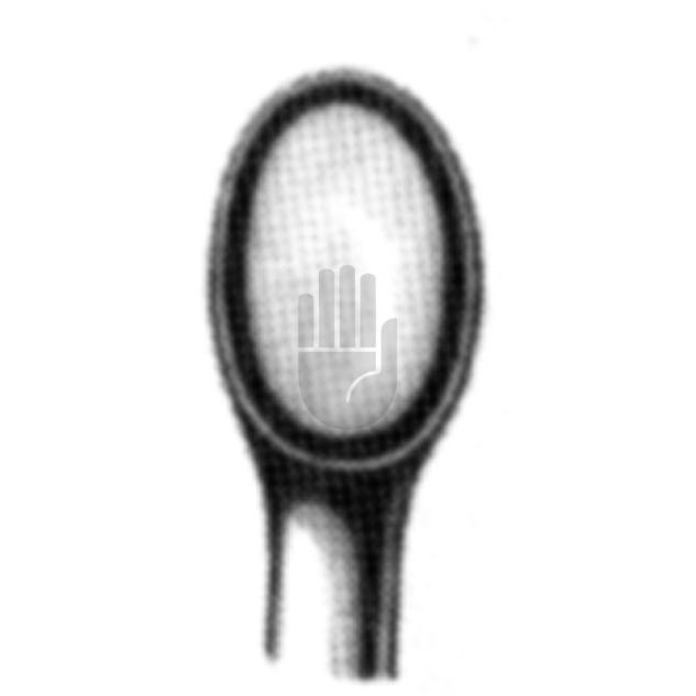 Daubenspeck 