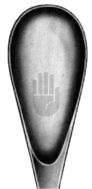 Luer-Koerte 